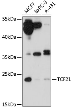 Western blot analysis of extracts of various cell lines using TCF21 Polyclonal Antibody at 1:1000 dilution.