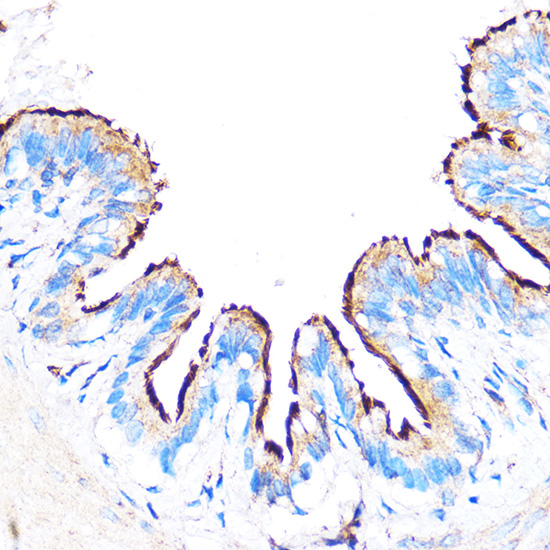 Immunohistochemistry of paraffin-embedded Rat lung using PDXP Polyclonal Antibody at dilution of 1:100 (40x lens).Perform microwave antigen retrieval with 10 mM PBS buffer pH 7.2 before commencing with IHC staining protocol.