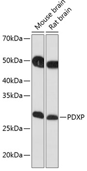 Western blot analysis of extracts of various cell lines using PDXP Polyclonal Antibody at 1:1000 dilution.