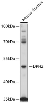 Western blot analysis of extracts of Mouse thymus using DPH2 Polyclonal Antibody at 1:1000 dilution.