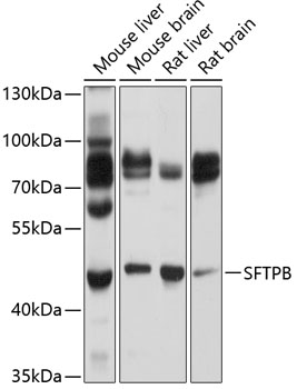 Western blot analysis of extracts of various cell lines using SFTPB Polyclonal Antibody at 1:1000 dilution.