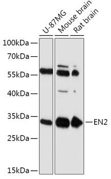 Western blot analysis of extracts of various cell lines using EN2 Polyclonal Antibody at 1:1000 dilution.