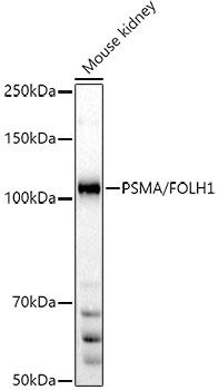 Western blot analysis of extracts of Mouse kidney using PSMA/FOLH1 Polyclonal Antibody at 1:500 dilution.