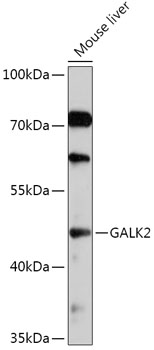 Western blot analysis of extracts of Mouse liver using GALK2 Polyclonal Antibody at 1:1000 dilution.