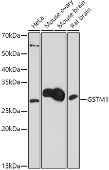 Western blot analysis of extracts of various cell lines using Polyclonal Antibody at1:1000 dilution.