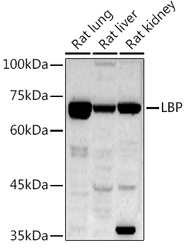 Western blot analysis of extracts of various cell lines using LBP Polyclonal Antibody at 1:1000 dilution.