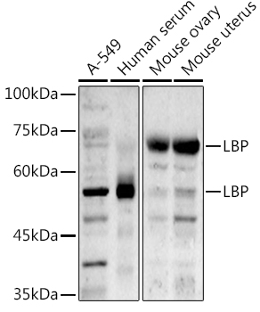 Western blot analysis of extracts of various cell lines using LBP Polyclonal Antibody at 1:1000 dilution.