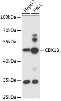 Western blot analysis of extracts of various cell lines using CDK18 Polyclonal Antibody at 1:1000 dilution.