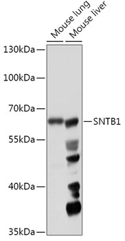 Western blot analysis of extracts of various cell lines using SNTB1 Polyclonal Antibody at 1:1000 dilution.