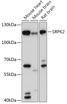 Western blot analysis of extracts of various cell lines using SRPK2 Polyclonal Antibody at 1:1000 dilution.