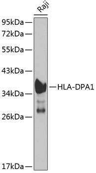 Western blot analysis of extracts of Raji cells using HLA-DPA1 Polyclonal Antibody at 1:1000 dilution.