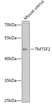 Western blot analysis of extracts of Mouse uterus using TM7SF2 Polyclonal Antibody at 1:1000 dilution.