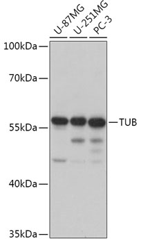 Western blot analysis of extracts of various cell lines using TUB Polyclonal Antibody at 1:1000 dilution.