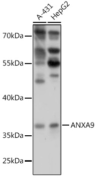 Western blot analysis of extracts of various cell lines using ANXA9 Polyclonal Antibody at 1:1000 dilution.