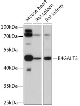 Western blot analysis of extracts of various cell lines using B4GALT3 Polyclonal Antibody at 1:1000 dilution.