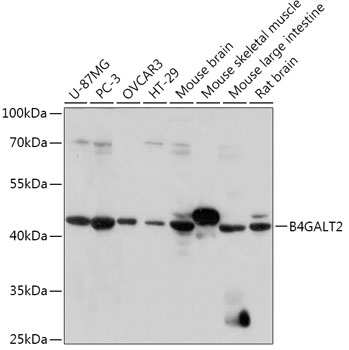 Western blot analysis of extracts of various cell lines using B4GALT2 Polyclonal Antibody at 1:1000 dilution.