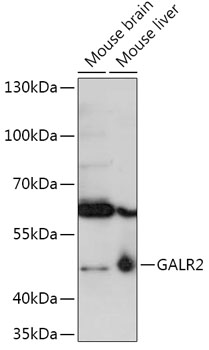 Western blot analysis of extracts of various cell lines using GALR2 Polyclonal Antibody at 1:1000 dilution.