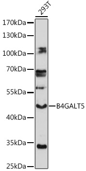 Western blot analysis of extracts of 293T cells using B4GALT5 Polyclonal Antibody at 1:1000 dilution.