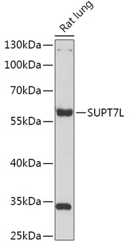 Western blot analysis of extracts of Rat lung using SUPT7L Polyclonal Antibody at 1:1000 dilution.