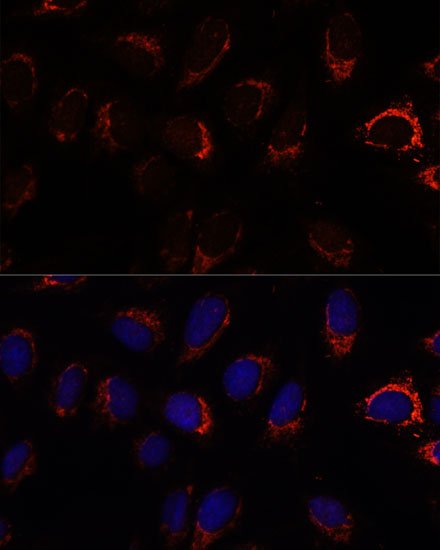 Immunofluorescence analysis of U2OS cells using AP3S2 Polyclonal Antibody at dilution of 1:100. Blue: DAPI for nuclear staining.