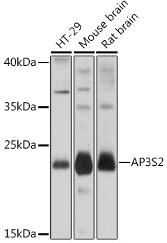 Western blot analysis of extracts of various cell lines using AP3S2 Polyclonal Antibody at1:1000 dilution.