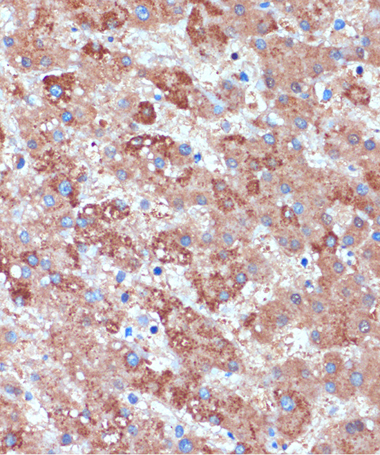 Immunohistochemistry of paraffin-embedded Human liver using B3GNT3 Polyclonal Antibody at dilution of 1:100 (40x lens).Perform microwave antigen retrieval with 10 mM PBS buffer pH 7.2 before commencing with IHC staining protocol.