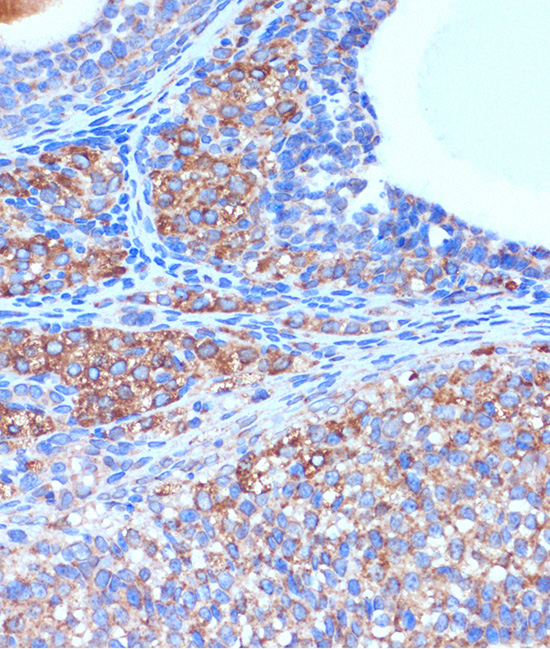 Immunohistochemistry of paraffin-embedded Rat ovary using B3GNT3 Polyclonal Antibody at dilution of 1:100 (40x lens).Perform microwave antigen retrieval with 10 mM PBS buffer pH 7.2 before commencing with IHC staining protocol.