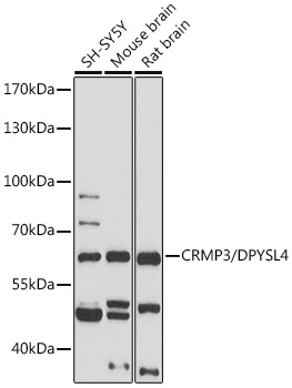 Western blot analysis of extracts of various cell lines using CRMP3/DPYSL4 Polyclonal Antibody at 1:1000 dilution.