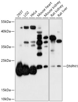 Western blot analysis of extracts of various cell lines using DNPH1 Polyclonal Antibody at 1:1000 dilution.