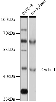 Western blot analysis of extracts of various cell lines using Cyclin I Polyclonal Antibody at 1:1000 dilution.