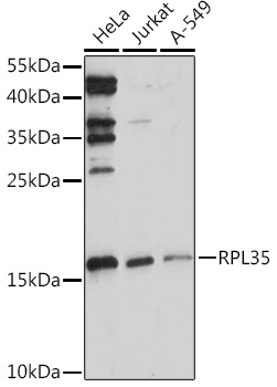 Western blot analysis of extracts of various cell lines using RPL35 Polyclonal Antibody at1:1000 dilution.