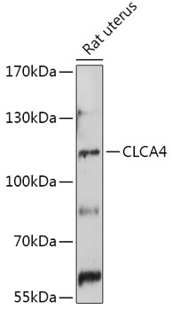 Western blot analysis of extracts of Rat uterus using CLCA4 Polyclonal Antibody at 1:1000 dilution.