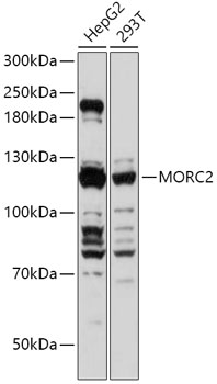 Western blot analysis of extracts of various cell lines using MORC2 Polyclonal Antibody at 1:1000 dilution.