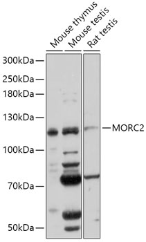 Western blot analysis of extracts of various cell lines using MORC2 Polyclonal Antibody at 1:1000 dilution.