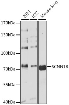 Western blot analysis of extracts of various cell lines using SCNN1B Polyclonal Antibody at 1:3000 dilution.