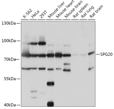 Western blot analysis of extracts of various cell lines using SPG20 Polyclonal Antibody at 1:1000 dilution.