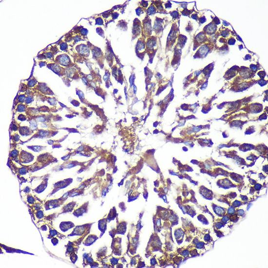 Immunohistochemistry of paraffin-embedded Rat testis using ANKLE2 Polyclonal Antibody at dilution of 1:100 (40x lens).Perform microwave antigen retrieval with 10 mM PBS buffer pH 7.2 before commencing with IHC staining protocol.