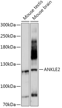 Western blot analysis of extracts of various cell lines using ANKLE2 Polyclonal Antibody at 1:1000 dilution.