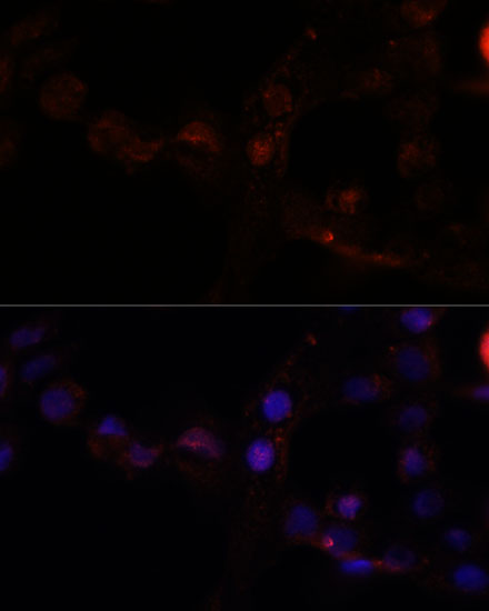 Immunofluorescence analysis of A431 cells using CAPN7 Polyclonal Antibody at dilution of 1:100. Blue: DAPI for nuclear staining.