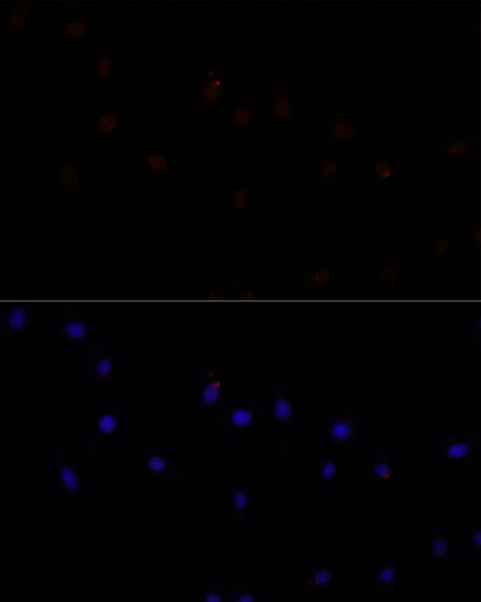 Immunofluorescence analysis of L929 cells using CAPN7 Polyclonal Antibody at dilution of 1:100. Blue: DAPI for nuclear staining.