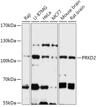 Western blot analysis of extracts of various cell lines using PRKD2 Polyclonal Antibody at 1:1000 dilution.