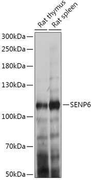 Western blot analysis of extracts of various cell lines using SENP6 Polyclonal Antibody at 1:1000 dilution.