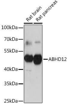 Western blot analysis of extracts of various cell lines using ABHD12 Polyclonal Antibody at 1:1000 dilution.