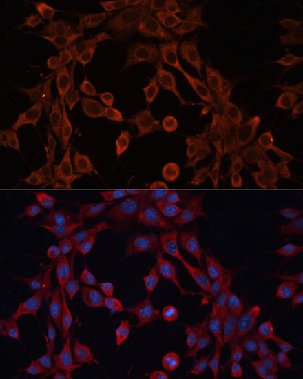 Immunofluorescence analysis of NIH-3T3 cells using ABCA12 Polyclonal Antibody at dilution of 1:100 (40x lens). Blue: DAPI for nuclear staining.