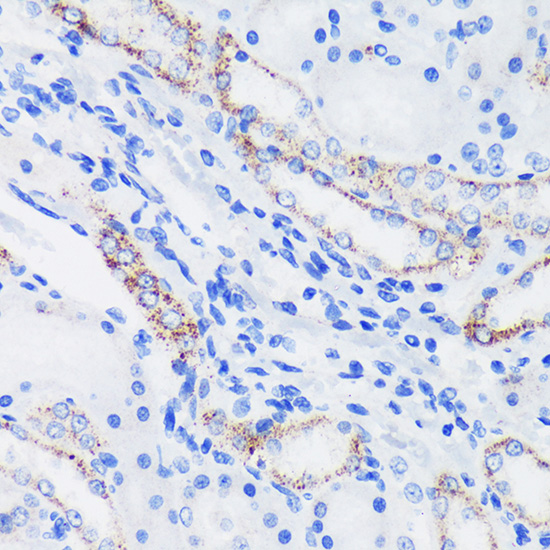 Immunohistochemistry of paraffin-embedded Rat kidney using EPN1 Polyclonal Antibody at dilution of 1:100 (40x lens).Perform microwave antigen retrieval with 10 mM PBS buffer pH 7.2 before commencing with IHC staining protocol.