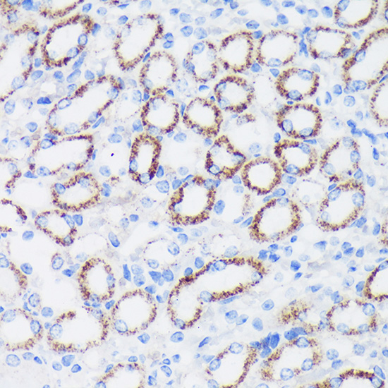 Immunohistochemistry of paraffin-embedded Mouse kidney using EPN1 Polyclonal Antibody at dilution of 1:100 (40x lens).Perform microwave antigen retrieval with 10 mM PBS buffer pH 7.2 before commencing with IHC staining protocol.