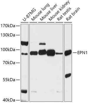 Western blot analysis of extracts of various cell lines using EPN1 Polyclonal Antibody at 1:1000 dilution.