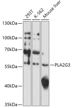 Western blot analysis of extracts of various cell lines using PLA2G3 Polyclonal Antibody at 1:1000 dilution.