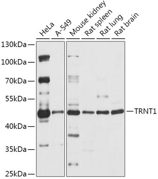 Western blot analysis of extracts of various cell lines using TRNT1 Polyclonal Antibody at 1:1000 dilution.