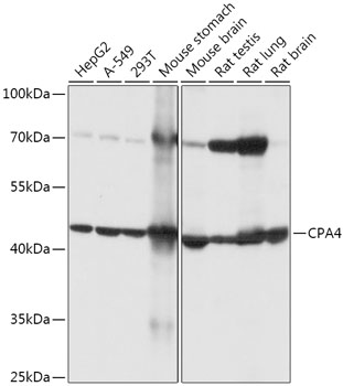 Western blot analysis of extracts of various cell lines using CPA4 Polyclonal Antibody at 1:1000 dilution.